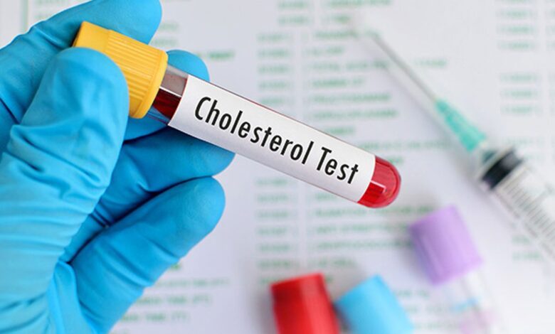 Foods that harm or benefit cholesterol