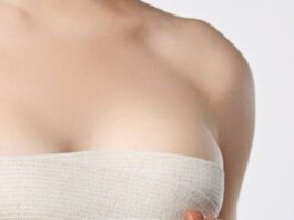 Benefits and Side Effects of Breast Reduction Surgery