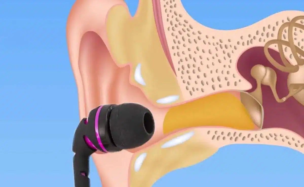 earbuds in ear 4 Warning for Ear Infections Caused by Earbuds