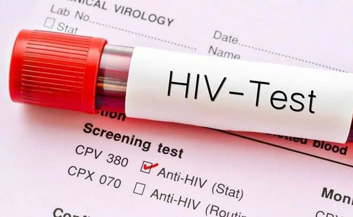 hiv Are multiple sexual partners beneficial for sexual wellness?
