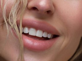 how to get rid of dark upper lip naturally