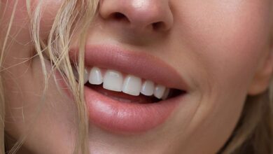 how to get rid of dark upper lip naturally