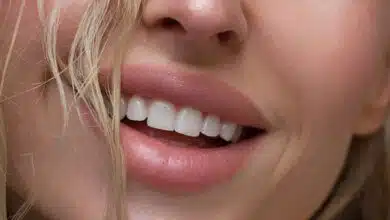 how to get rid of dark upper lip naturally