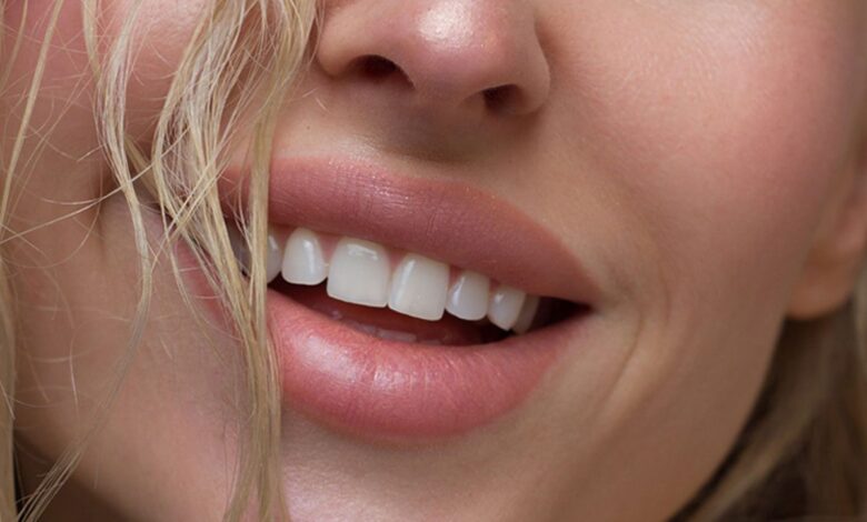 how to get rid of dark upper lip naturally