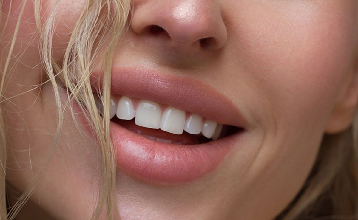 how to get rid of dark upper lip naturally