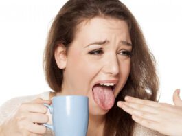 Home remedies to cure Burnt Tongue quickly