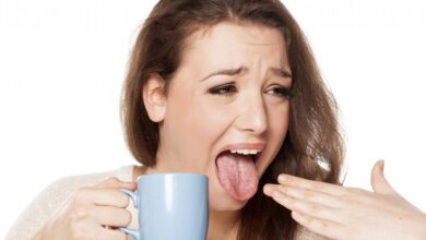 Home remedies to cure Burnt Tongue quickly