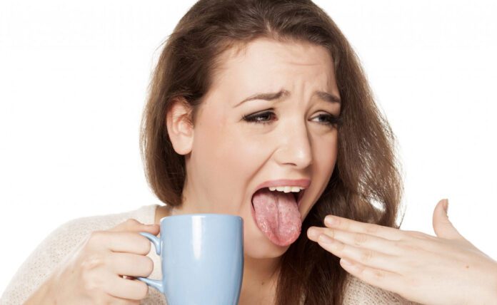 Home remedies to cure Burnt Tongue quickly