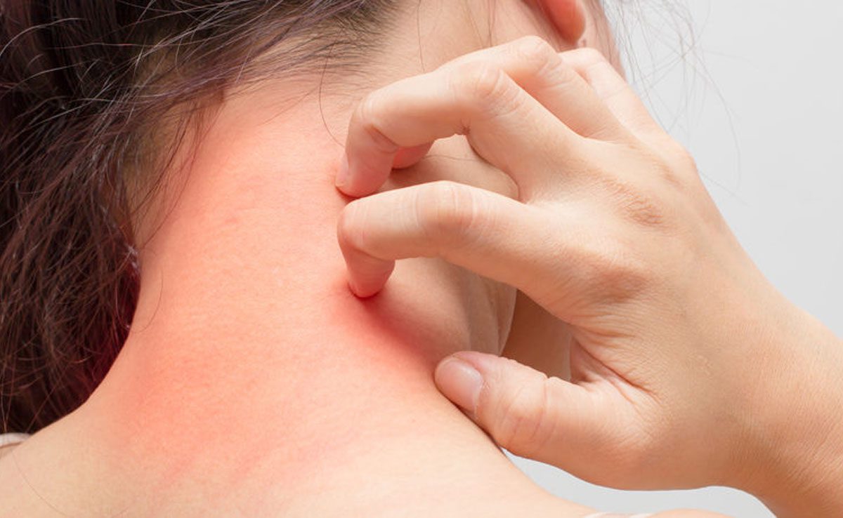 dry or itchy skin Symptoms of Omega-3 deficiency in the body