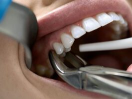 What to eat and what to eat after tooth extraction?