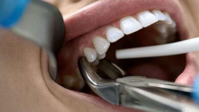 What to eat and what to eat after tooth extraction?