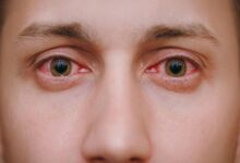 Eye Care: 6 Ways To Avoid Eye Infections During Monsoon