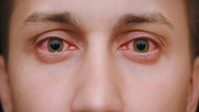 Eye Care: 6 Ways To Avoid Eye Infections During Monsoon