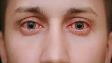 Eye Care: 6 Ways To Avoid Eye Infections During Monsoon