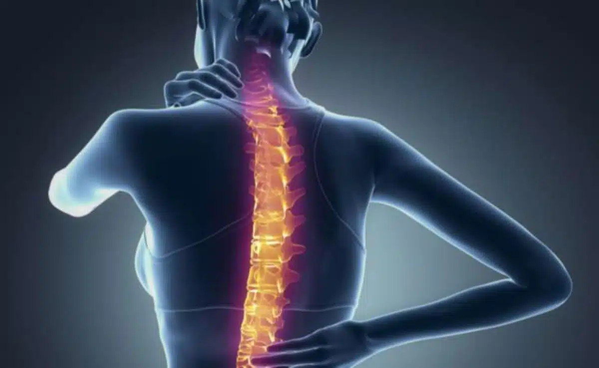 osteoporosis