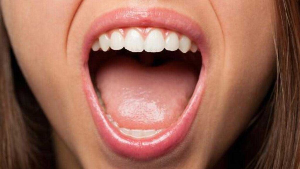 Dry Mouth: What is it?