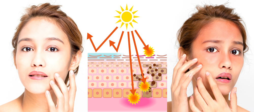 7 ways to protect yourself from the scorching sun 2