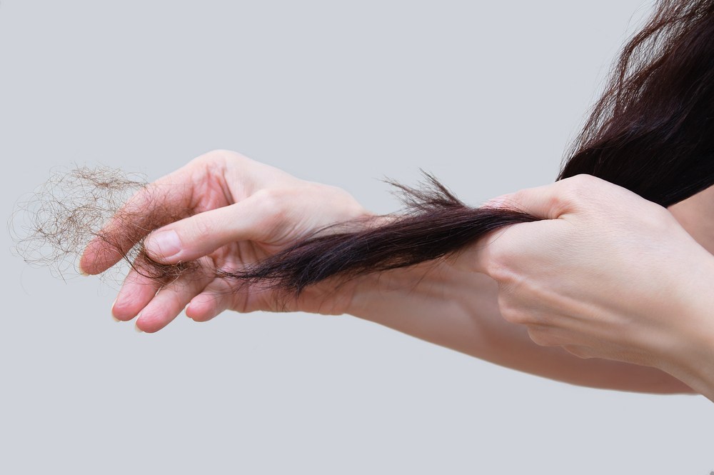 10 Amazing Ways to Prevent Hair Fall 1
