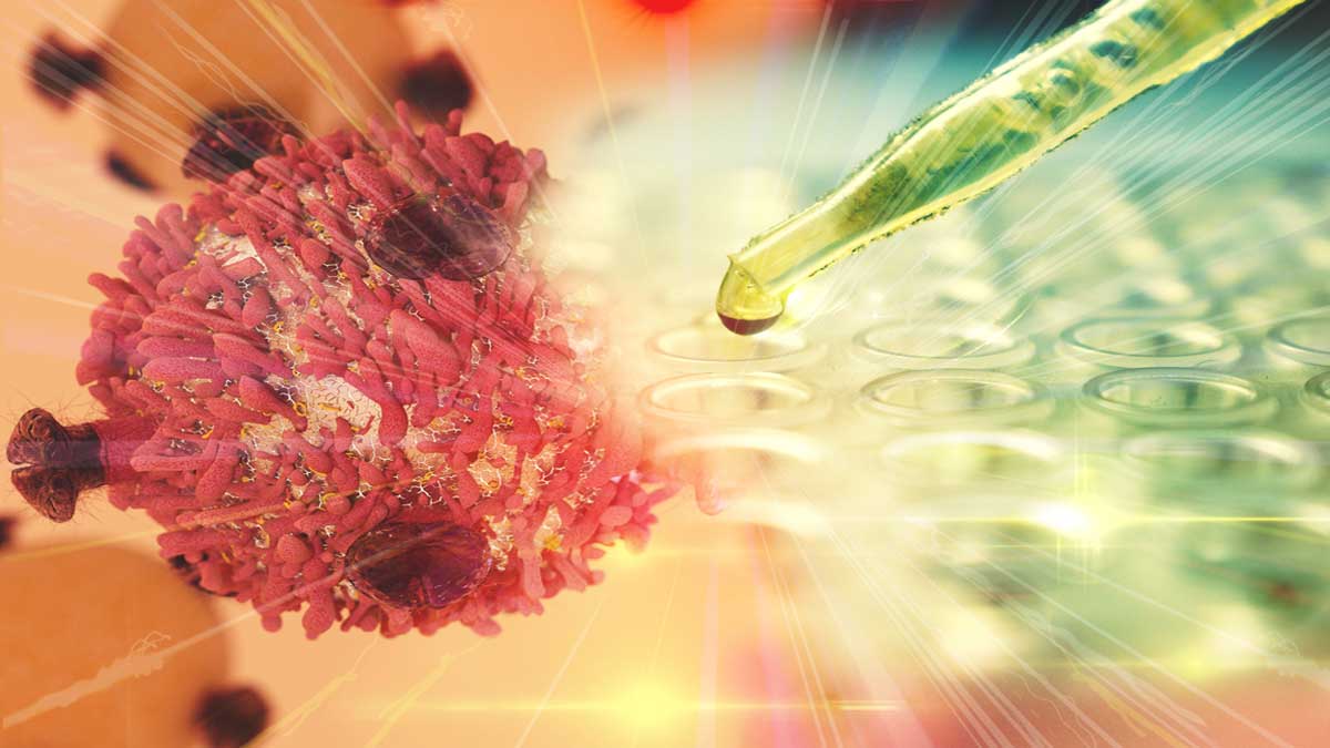 Cancer symptoms and treatment 2