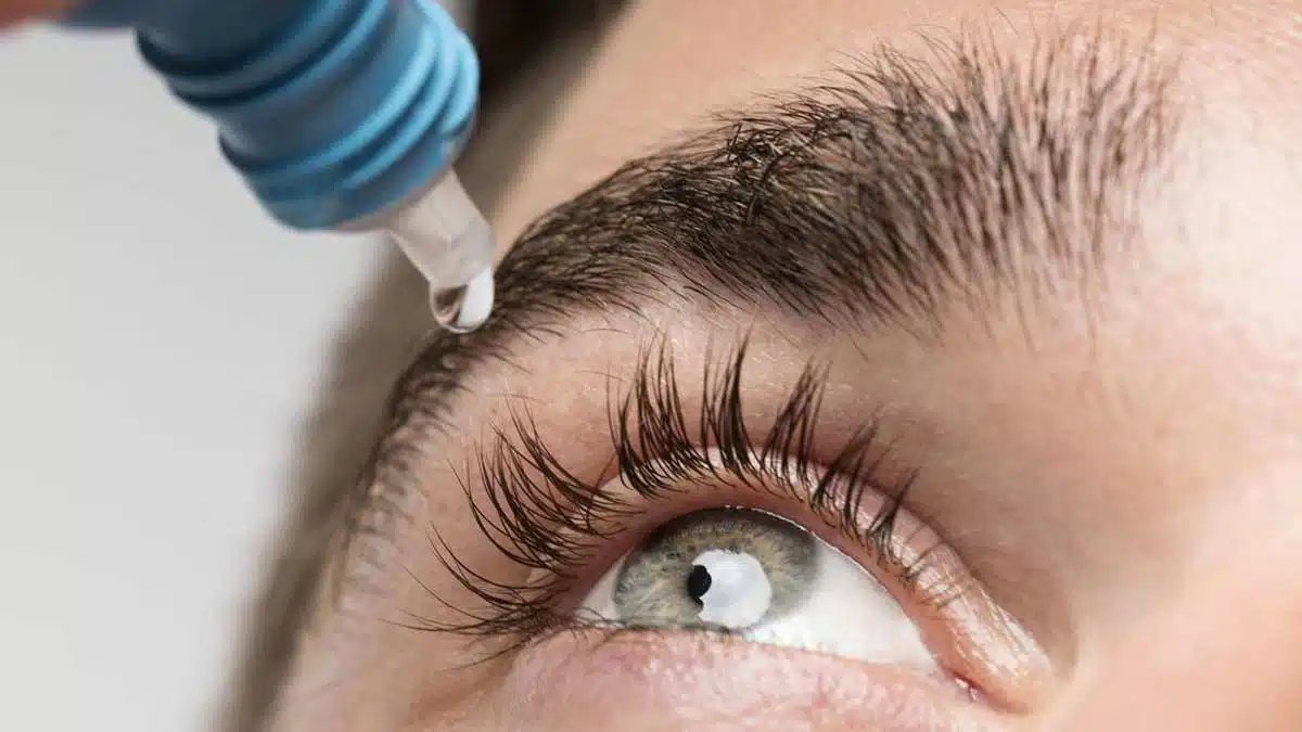Eye Flu Symptoms, Causes and Home Remedies