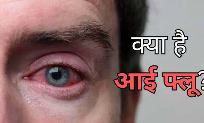 Eye Flu Symptoms, Causes and Home Remedies