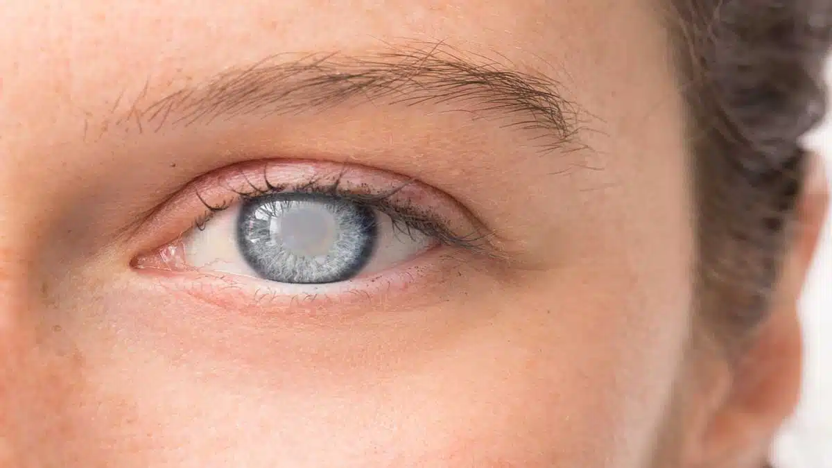 Eye Problems Causes and Treatment