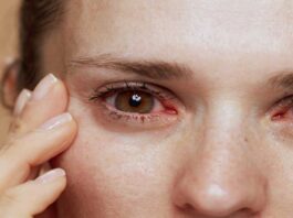 Eye diseases- know the signs and treatment