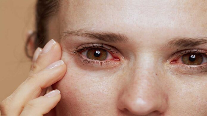 Eye diseases- know the signs and treatment