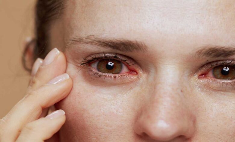 Eye diseases- know the signs and treatment