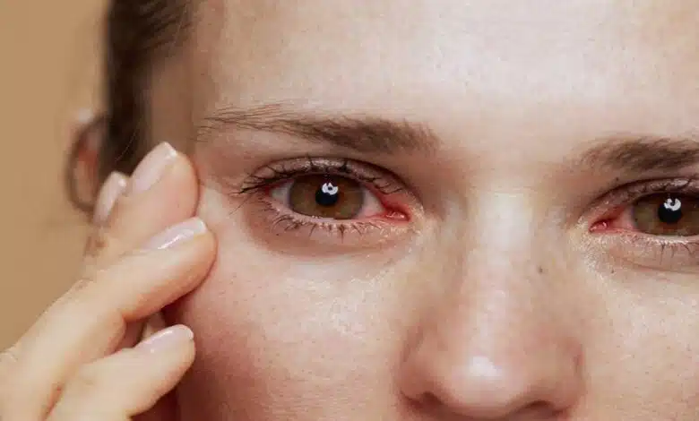 Eye diseases- know the signs and treatment