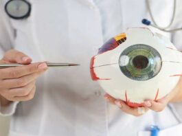 General knowledge of eye diseases