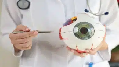 General knowledge of eye diseases