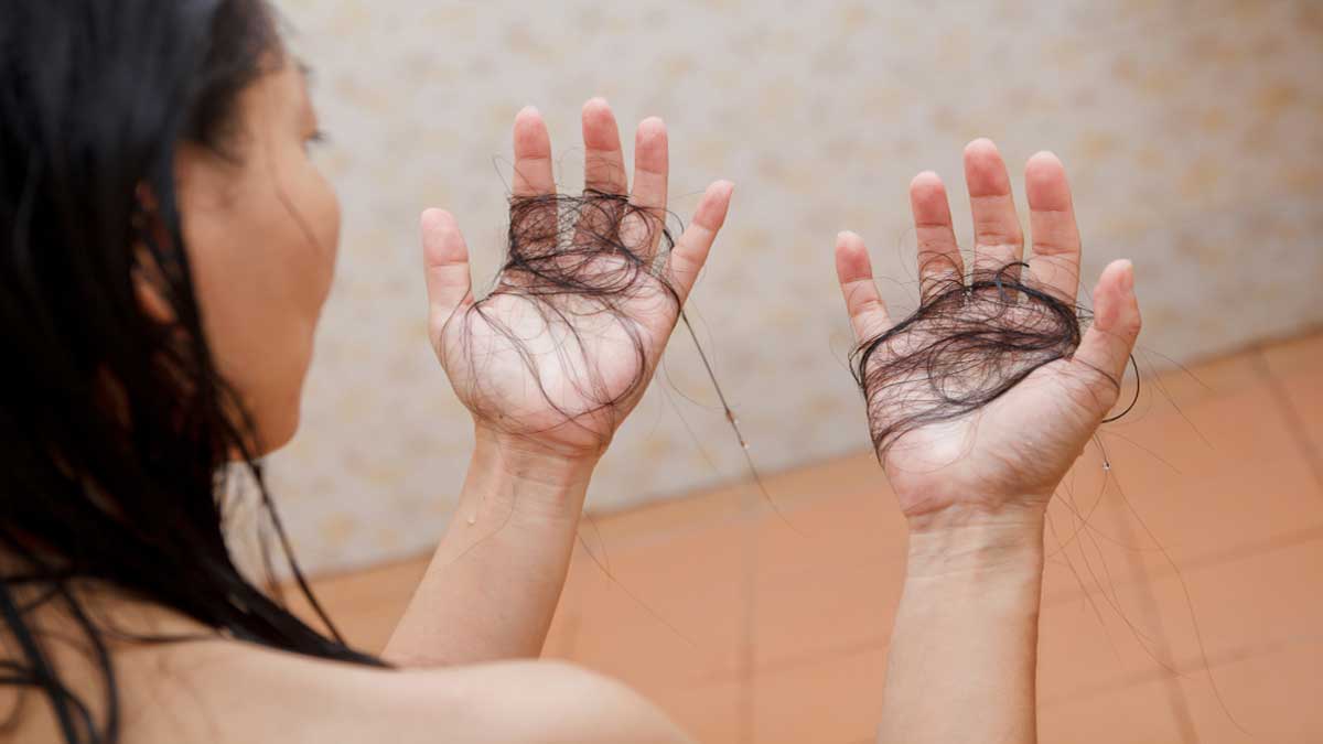Hair fall Here is the best hairfall solution Hair fall Here is the best hairfall solution