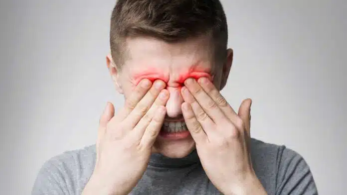 Home remedies for eye problems