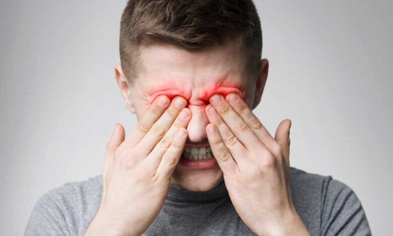 Home remedies for eye problems
