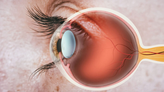 Home remedies for eye problems