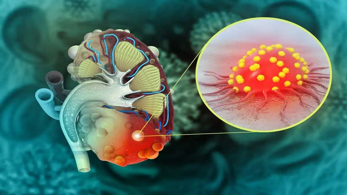 How can kidney disease be prevented 2