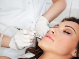 Information about Laser Treatment for Acne Scars