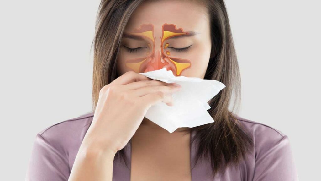 Irregular runny nose causes and treatment 2