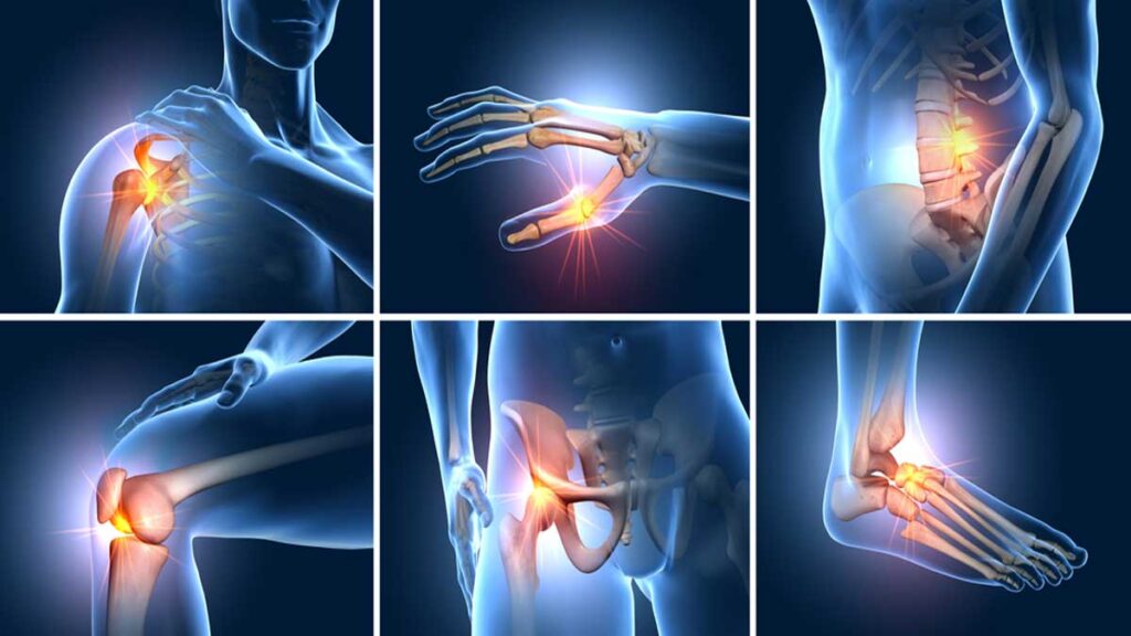Joint pain get rid of it with easy remedies 1