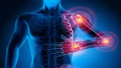 Joint pain- how to treat