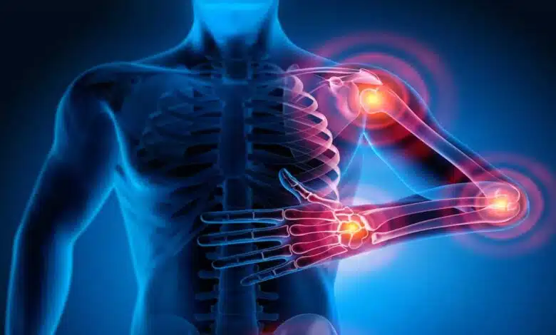 Joint pain- how to treat
