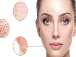 Know the experienced methods and remedies of skincare