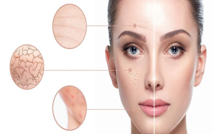 Know the experienced methods and remedies of skincare