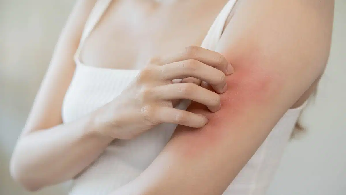 Know the experienced methods and remedies of skincare 3 Know the experienced methods and remedies of skincare 3