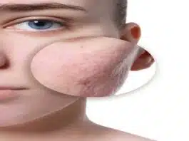 Make skin glow simple skincare tips