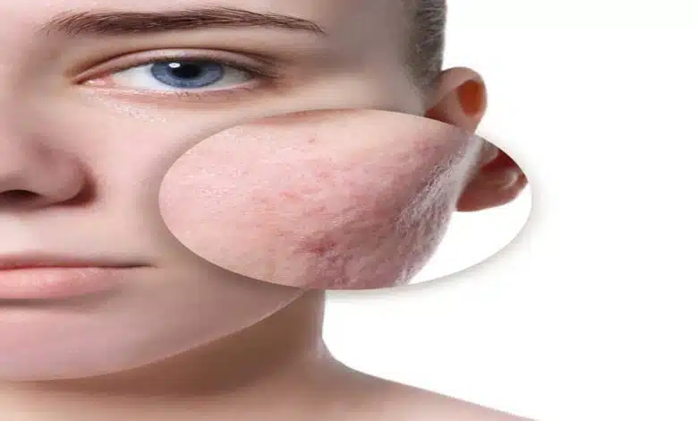 Make skin glow simple skincare tips