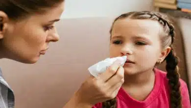 Nose bleeding symptoms and treatment