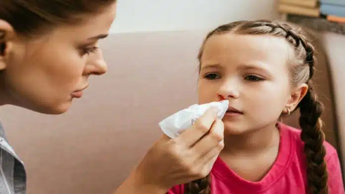 Nose bleeding symptoms and treatment