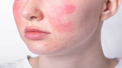 Skincare Tips- Best skincare regimen for glowing skin